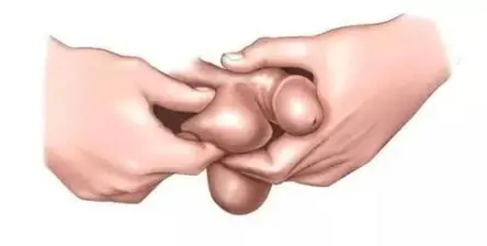 睾丸炎676 (1)